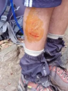 A rub from gaiters