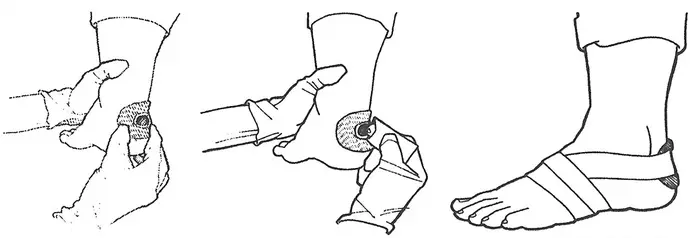 Taping a heel